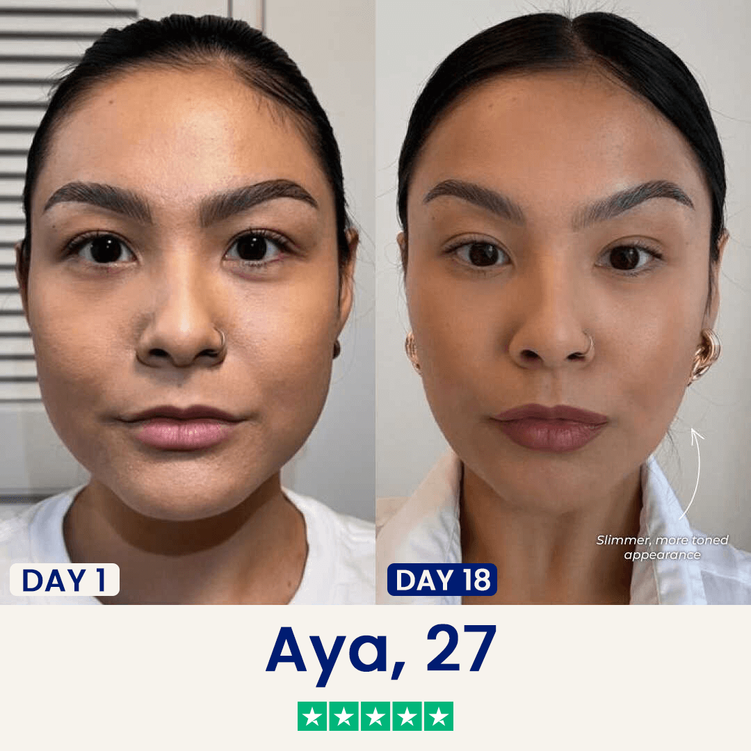 The Chinology™ Lift (New Version)