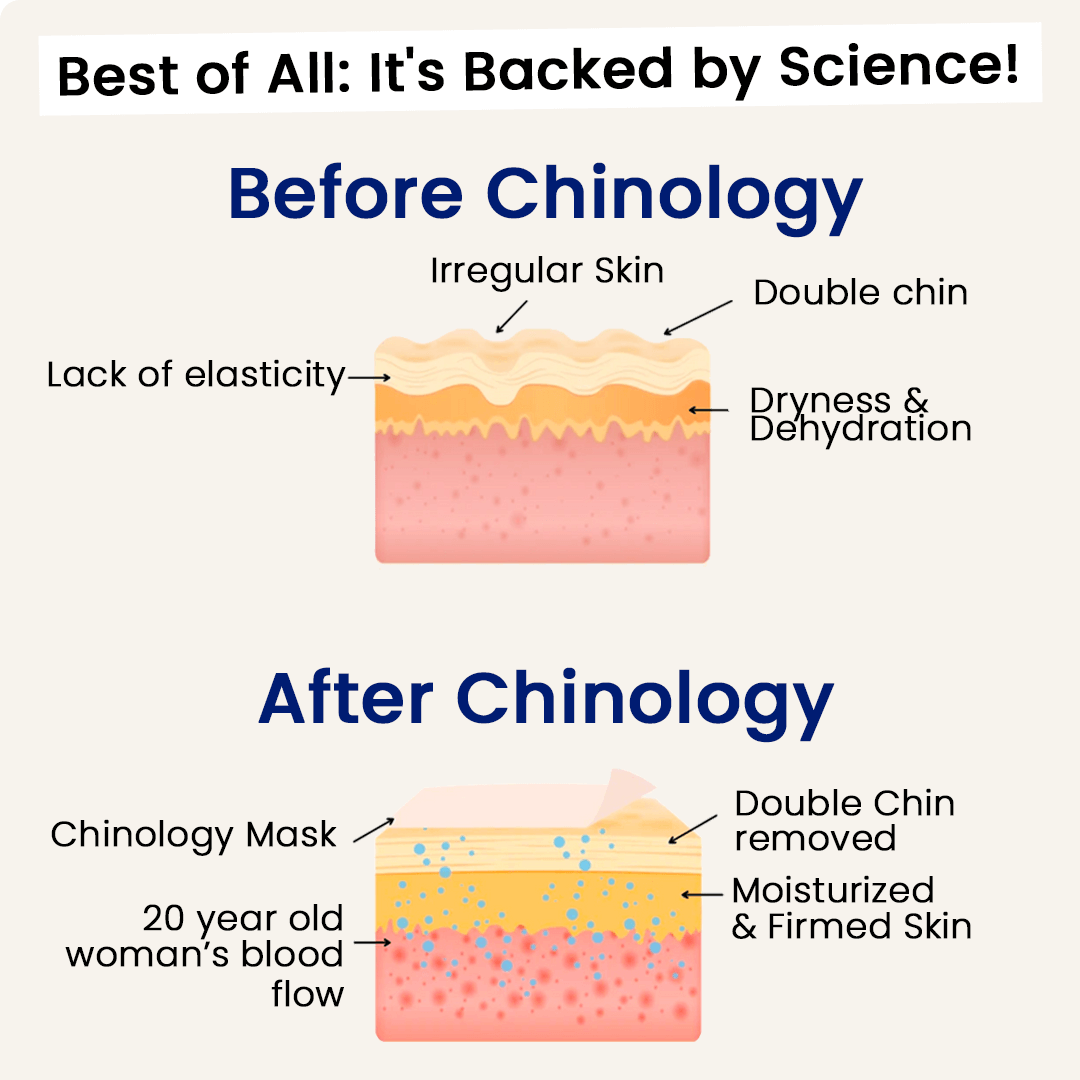 Chinology Night Mask – Maximize Results and Eliminate Your Double Chin